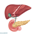 Gallbladder Surgery – Dr Mark Magdy